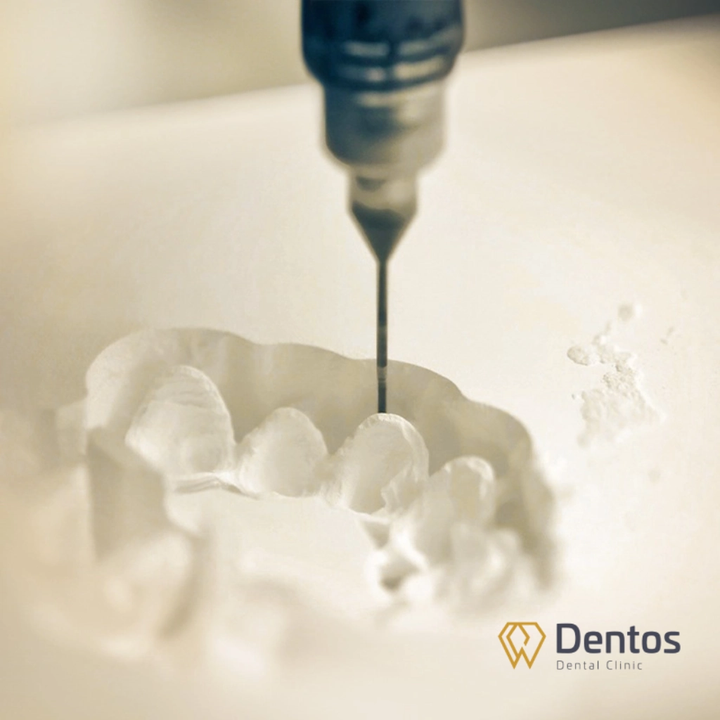 Dentos sở hữu công nghệ CAM/CAD giúp răng sứ khít sát, bền lâu